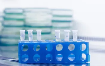 Nieuwe DNA-test kan daders van seksueel geweld ook identificeren bij minimaal bewijsmateriaa